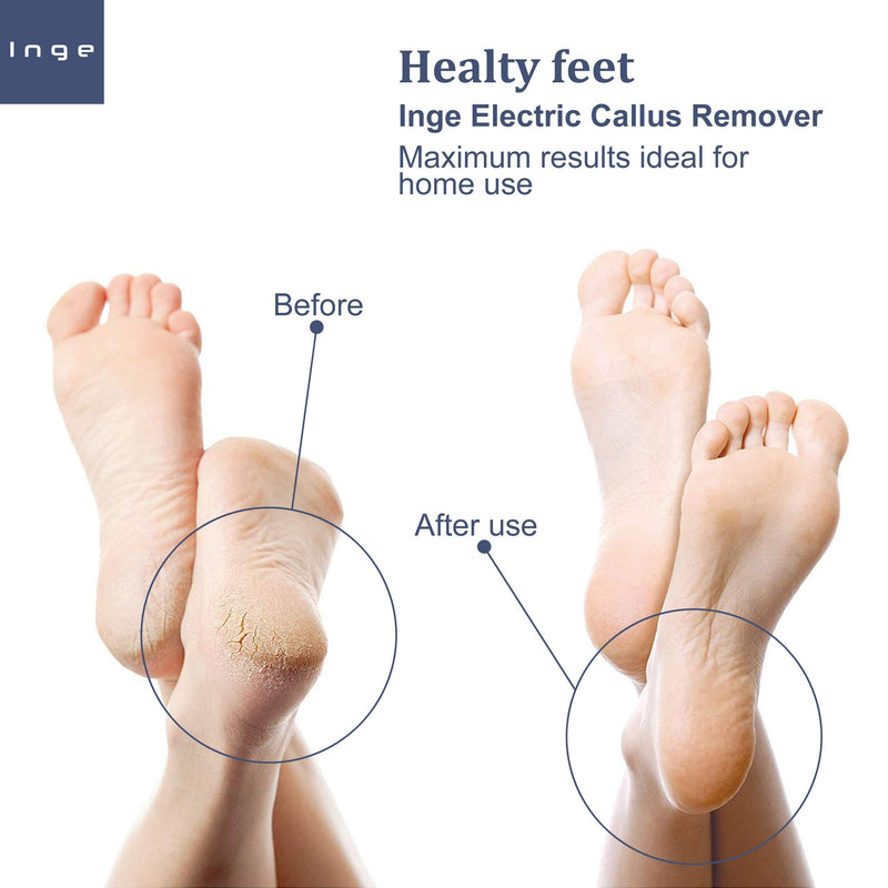 Inge Electric Foot File & Hard Skin Remover | Callus Remover for Feet & Dry Dead Skin Remover and Exfoliator with 3 Replacement Washable Rollers | Rechargeable - Waterproof - White - NewNest Australia