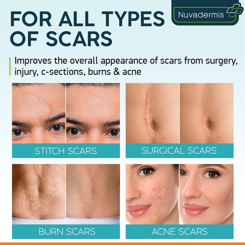 Scar Cream Gel - Advanced Post Surgery Supplies - C-Section, Tummy Tuck, Keloid, Acne Removal Treatment - Retinol, Allantoin,Vitamin E- Try with Surgical Silicone Sheets, Tapes, Patches - 1.7 oz - NewNest Australia
