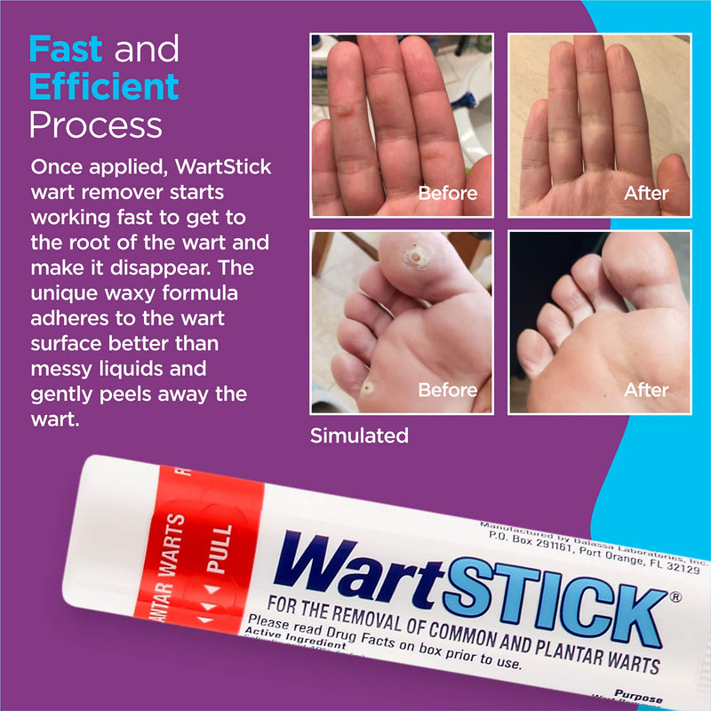 WartStick Maximum Strength Salicylic Acid Solid-Stick Common and Plantar Wart Remover 0.2 Oz - NewNest Australia