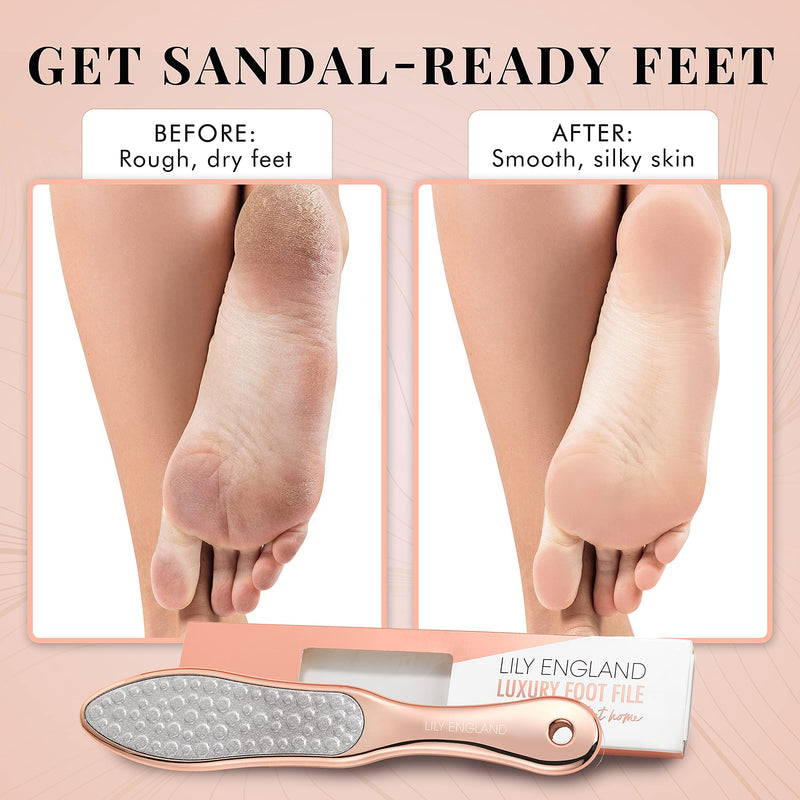 Foot File Hard Skin Remover - 2-in-1 Professional Footfile and Dry Skin Remover for Feet, Stainless Steel Pedicure Tool by Lily England, Rose Gold - NewNest Australia