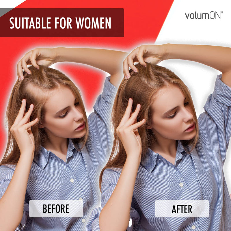 Hair Fibres x2 VOLUMON Keratin Hair Building Fibres for Thinning Hair - Instantly Conceals Thinning Areas for Fuller Thicker Hair - For Men & Women 28g x2 (Auburn) Auburn - NewNest Australia