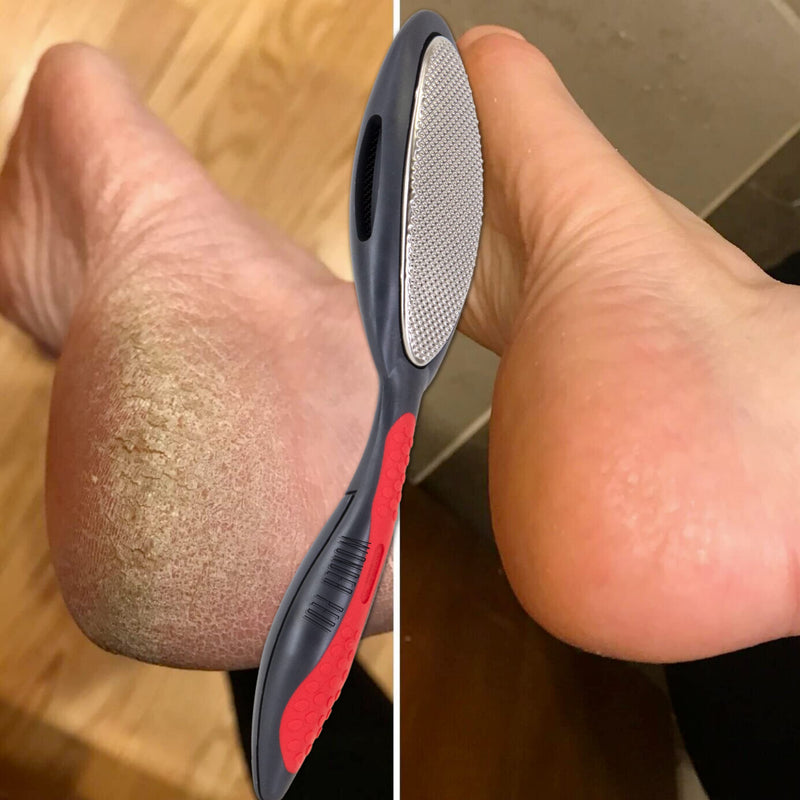 Wonder Pedi Double Sided Metal Foot File - Stainless Steel Feet Callus Remover Made in Germany - Feet Scrubber Dead Skin - Heel Scraper for Cracked Heels Repair - Professional Foot Rasp - NewNest Australia