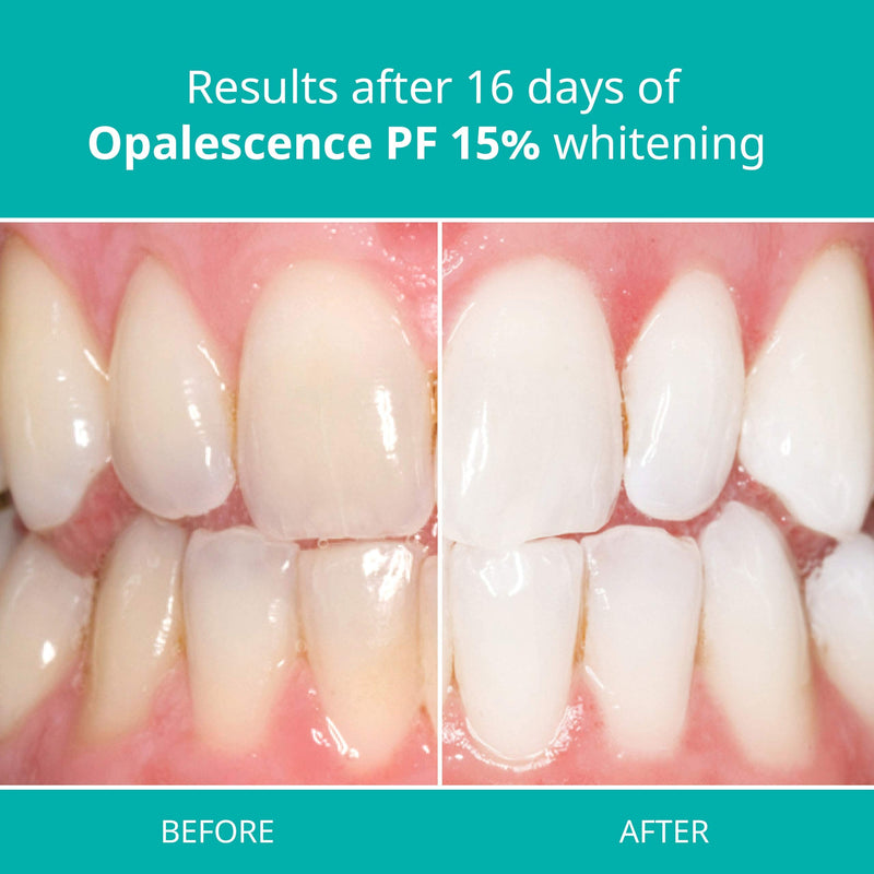 Opalescence at Home Teeth Whitening - Teeth Whitening Gel Syringes - 4 Pack of 15% Syringes - Mint 1 Count (Pack of 4) - NewNest Australia