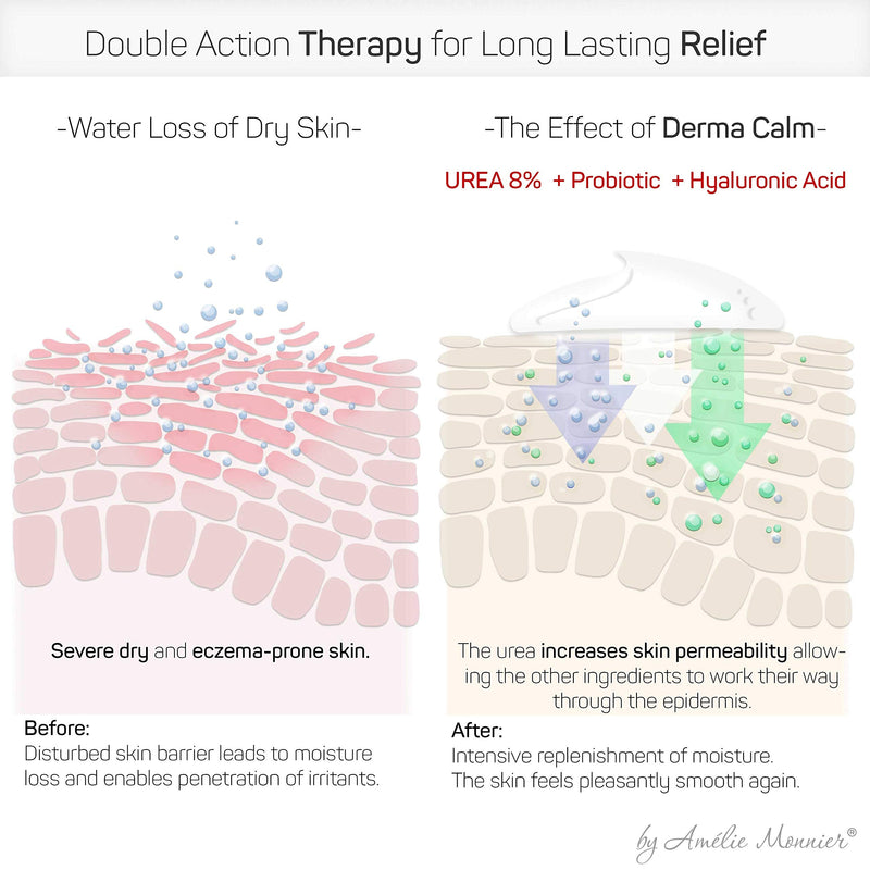 Clinically Tested Cream for Eczema, Dermatitis and Psoriasis Treatment - Urea 8%, Probiotics w/Best Natural Ingredients - Face & Body Lotion - Itchy, Severely Dry, Scaly Skin. Moisturizer - NewNest Australia