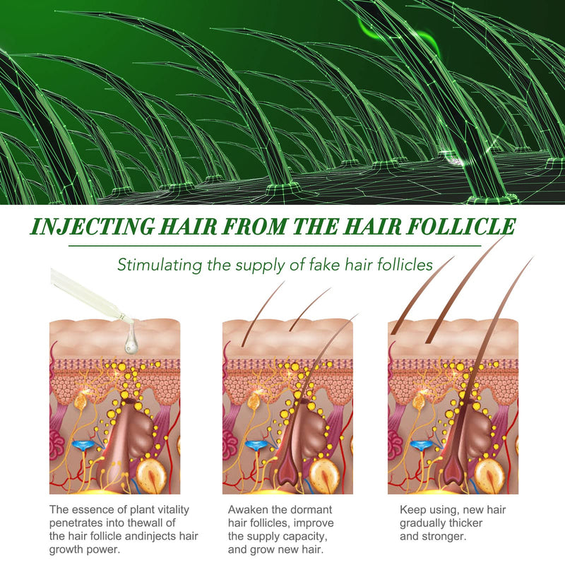 120 Ml Rosemary Oil Hair, Essential Rosemary Oil For Hair Growth, 100% Natural Rosemary Stimulates Hair Growth, Essential Rosemary Oil For Hair, Rosemary Oil For Scalp - NewNest Australia