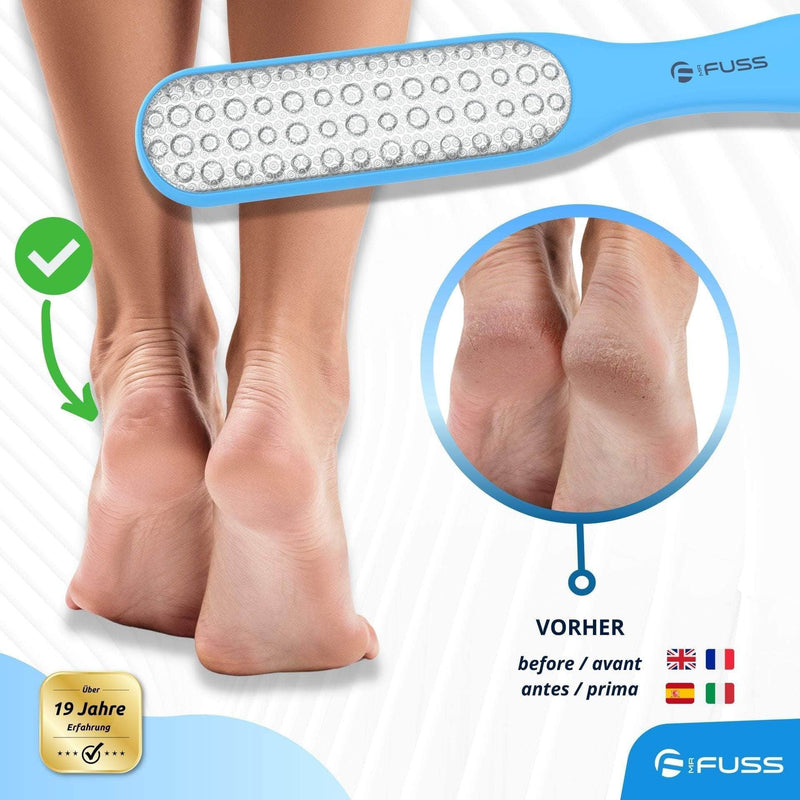 Mr. Fuss® Laser - Foot File - Pedicure Hard Skin Remover Metal Grinder. Callus Rasp Stainless Steel Feet Scrubber for Spa and Pedicure Care. Dead Skin Remover for Feet - NewNest Australia