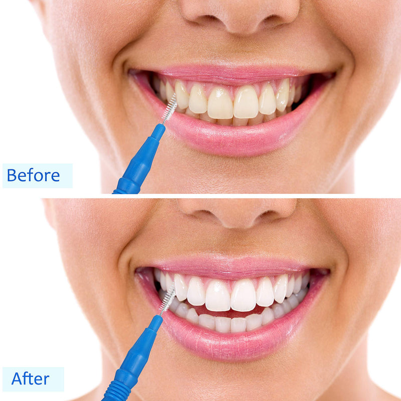 100 Pieces Braces Dental Brush Flosser for Cleaner Interdental Brush Toothpick Dental Tooth Flossing Head Oral Dental Hygiene Toothpick Cleaners Cleaning Tool Red and Blue - NewNest Australia