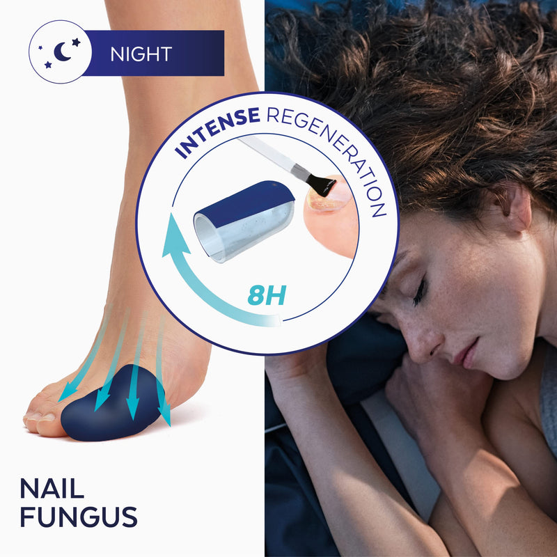 PODERM – 2-in-1 FUNGAL NAIL INTENSIVE NIGHT TREATMENT Eliminates the fungal infection and renews the nail while you sleep |VEGAN | Professional foot/hand treatment | Quick & Easy | Swiss Made - NewNest Australia