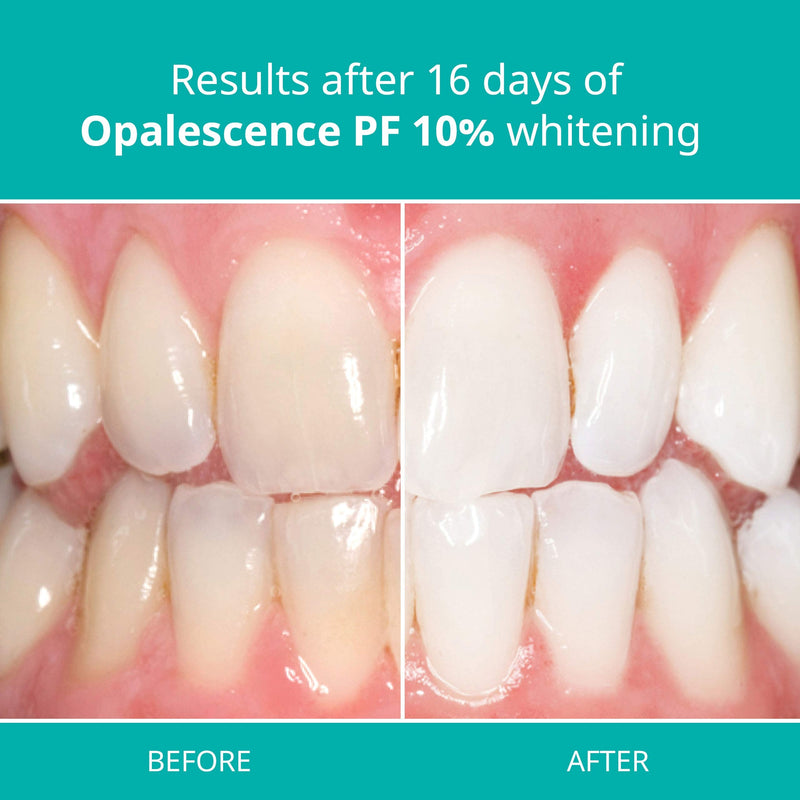Opalescence at Home Teeth Whitening - Teeth Whitening Gel Syringes - 4 Pack of 10% Syringes - Mint 1 Count (Pack of 4) - NewNest Australia