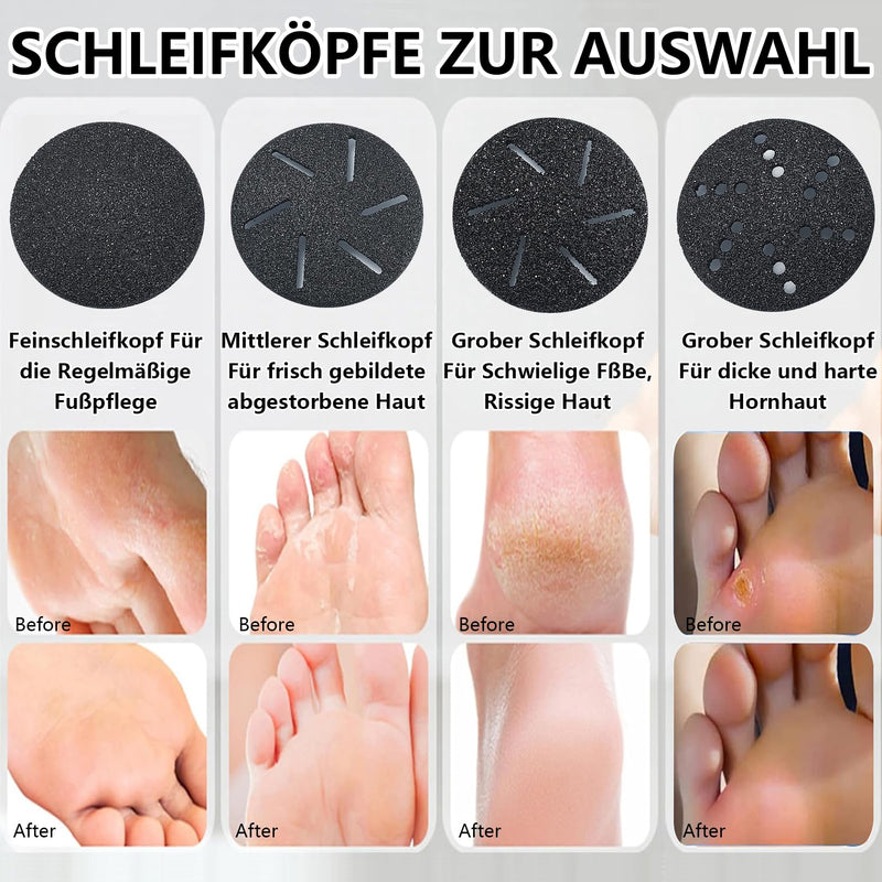 Callus Remover Electric, Rechargeable Callus Removal Foot with Strength Suction and 2 Levels Adjustable, Waterproof Professional Foot Care Pedicure (Black) Acrylonitrile Butadiene Styrene (ABS) - NewNest Australia