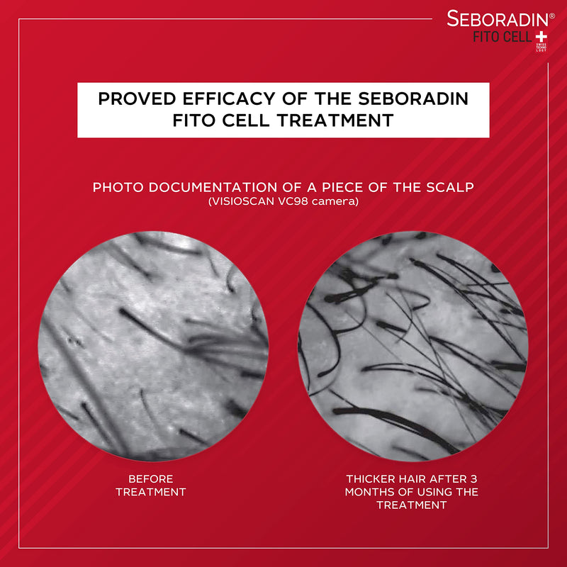 SEBORADIN FITO CELL Hair Shampoo for Stronger Hair 200 ml | Hair Loss and Regrowth | Swiss Technology Stem Cells Phytocelltec Malus Domestica | Hair & Scalp Treatment | Hair Care Hair Products - NewNest Australia
