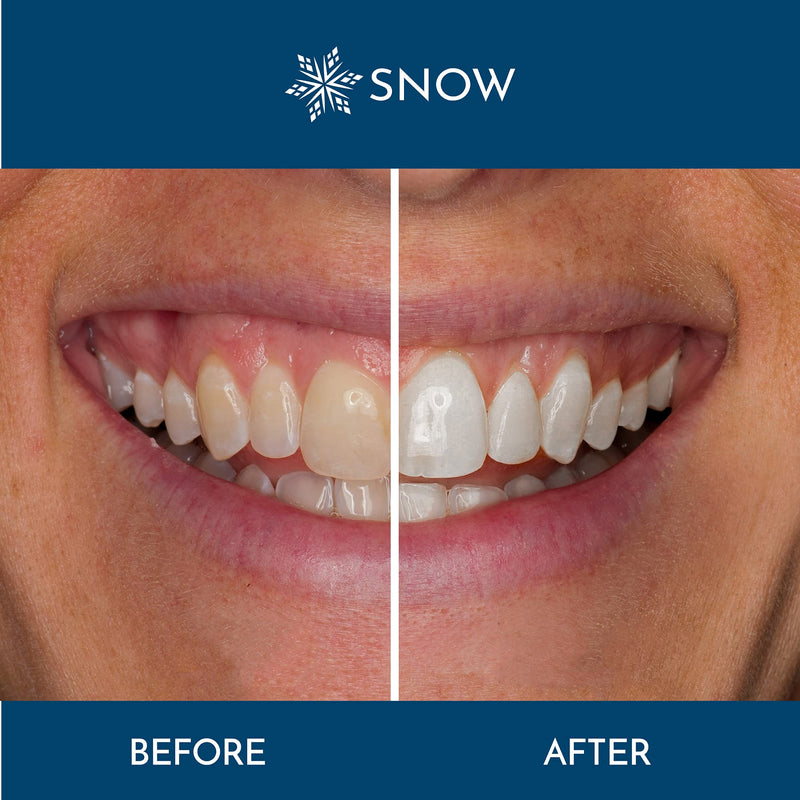 Snow Teeth Whitening Serum Refill (2 Pack) - Regular Strength Wands | Keep Up Your Whitening Routine - NewNest Australia