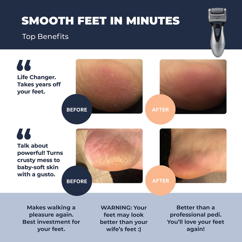 Electric Hard Skin Remover for Men by Own Harmony: USA's Best Rated Callus Remover- Rechargeable Pedicure Tools w 3 Coarse Rollers, Velvet-Smooth Foot Care- Professional Spa Pedi Feet File (USB Cord) - NewNest Australia