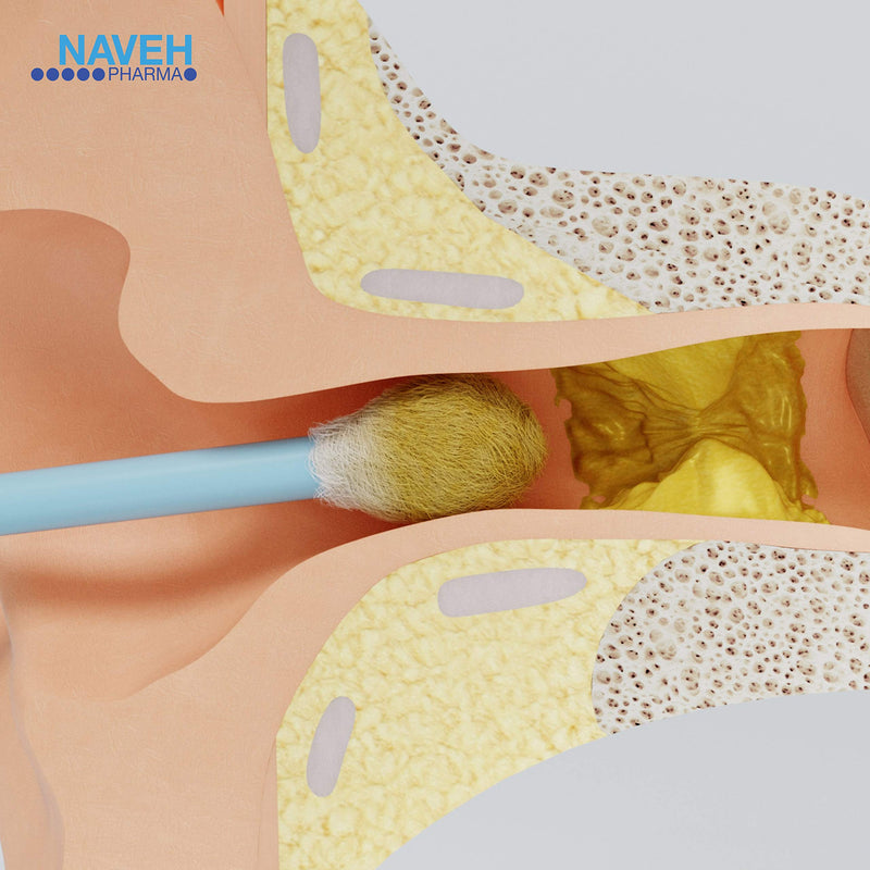 NAVEH PHARMA Otic Guard Natural Ear Wax Removal Spray – Herbal-Oil Blend for Ear Infections and Ear Pain in Adults – Ear Wax Softener for Clogged Ear Relief and Swimmer’s Ear 1 Fl Oz 1 Ounce (Pack of 1) - NewNest Australia
