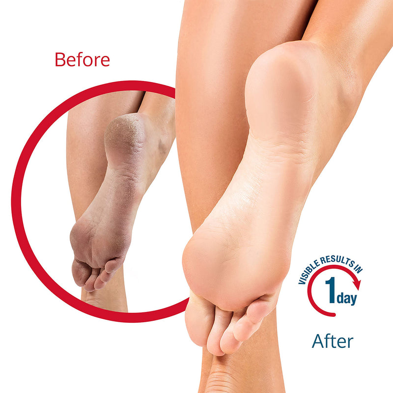 FLEXITOL Heel Balm Medically Proven Treatment for Dry and Cracked Feet - 112g |Gives Intense Moisturisation - NewNest Australia