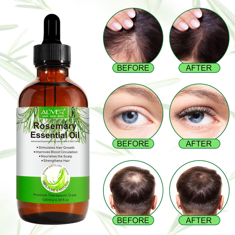 Rosemary Oil For Hair Growth & Skin Care - 100% Pure Rosemary Essential Oil For Eyebrows And Eyelashes, Nourishes The Scalp, Stimulates Hair Growth For Men Women (Pack Of 1 X 120 Ml) - NewNest Australia