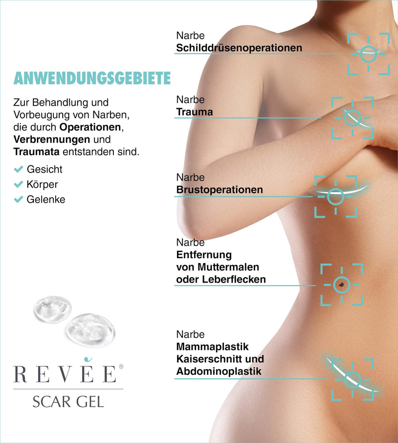 REVÉE Scar Gel Scar gel for face and body - scar ointment after surgery, silicone scar gel 100% medical, scar cream after surgery, transparent, odorless, quick absorption, scar cream 20 g - NewNest Australia