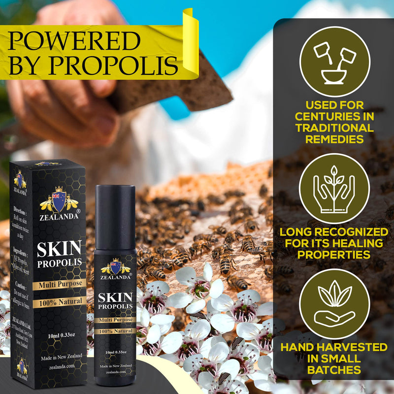 ZEALANDA Skin Propolis, Multi Purpose 100% Natural No Alcohol Treatment for Acne, Pimple, Eczema, Callus, Sunspot,Skin Rash, Insect Bites, Cuts & Wounds. Made & Packed in New Zealand - NewNest Australia