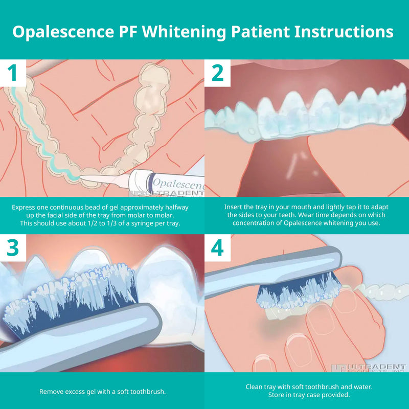 Opalescence at Home Teeth Whitening - Teeth Whitening Gel Syringes - 4 Pack of 10% Syringes - Mint 1 Count (Pack of 4) - NewNest Australia