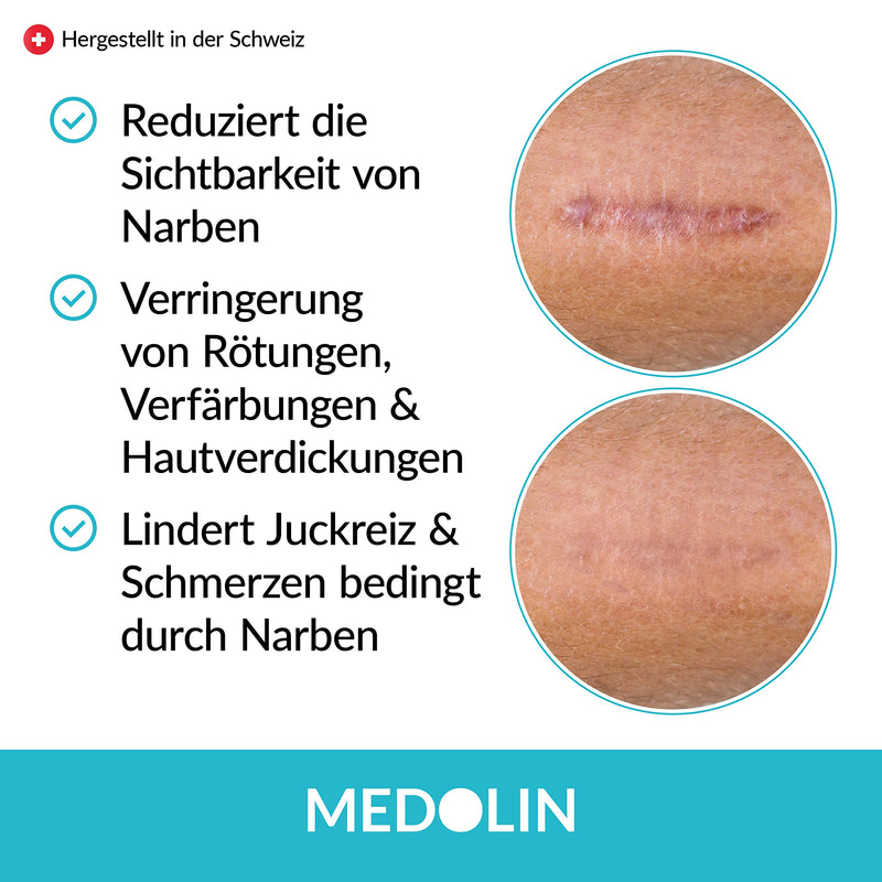 Medolin® Scar Ointment - Reduces the visibility of scars - Certified scar gel in the EU - Versatile & easy to use, 19 g - NewNest Australia