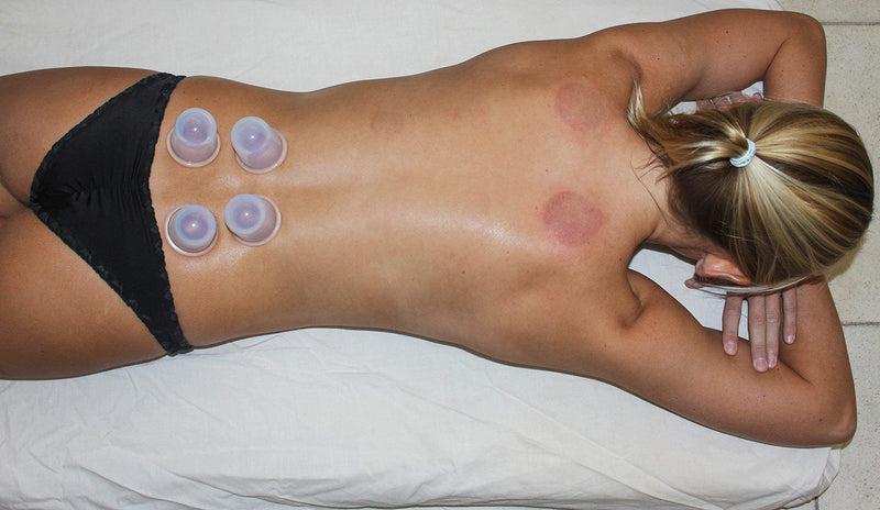 Cupping Set Massage Therapy Cups - by DoSensePro. Acupuncture Home Cupping Therapy Set for Arthritis, Pain Relief, Anti-Aging, Anti-Cellulite. Best Relaxation Gift. 6 Silicone Vacuum Cups. - NewNest Australia