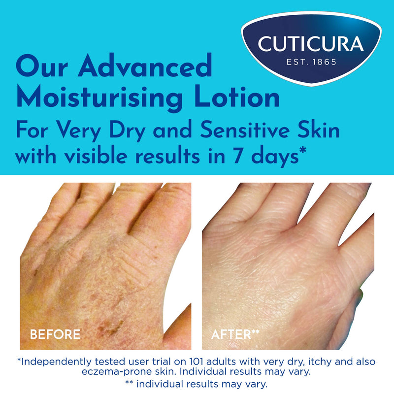 Cuticura Mildly Medicated Dry Skin Cream ml Advanced Moisturising Lotion For Very Dry and Sensitive Skin Suitable For Hands Feet and Body, Aloe Vera, 200 millilitre 200 ml (Pack of 1) - NewNest Australia