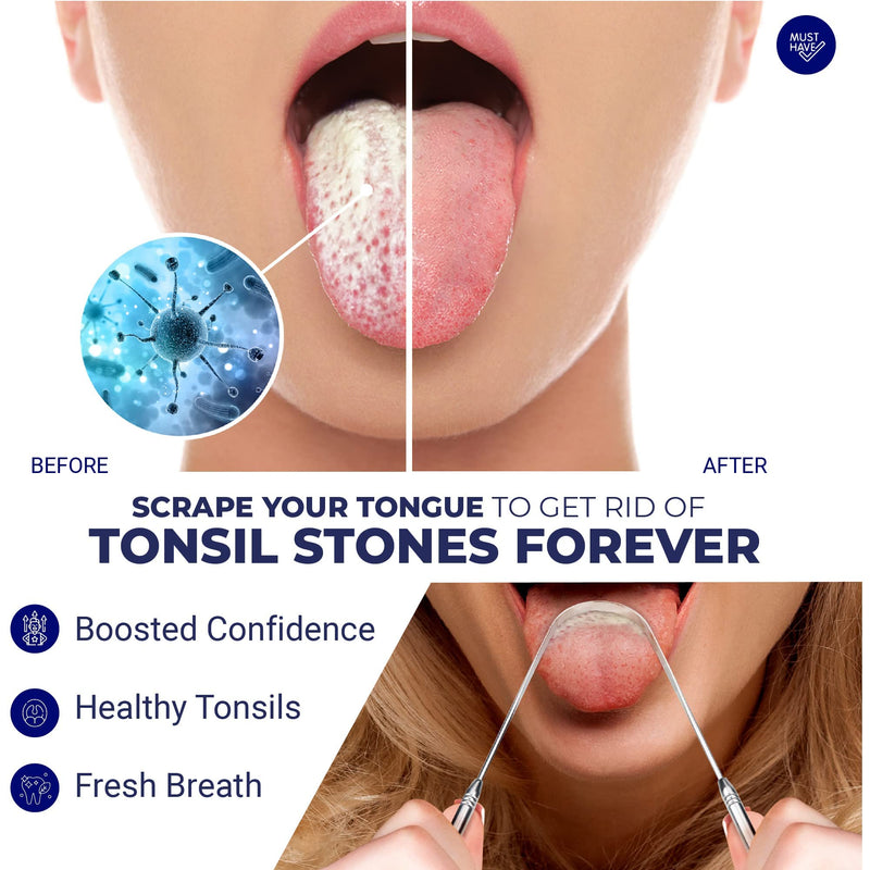 Orali Tonsil Stone Remover Set For Removing And Preventing Tonsil Stones, Combats Bad Breath, Relieves A Sore Throat, Syringe, Tonsil Stone Remover With Led Light And Tongue Cleaner - NewNest Australia