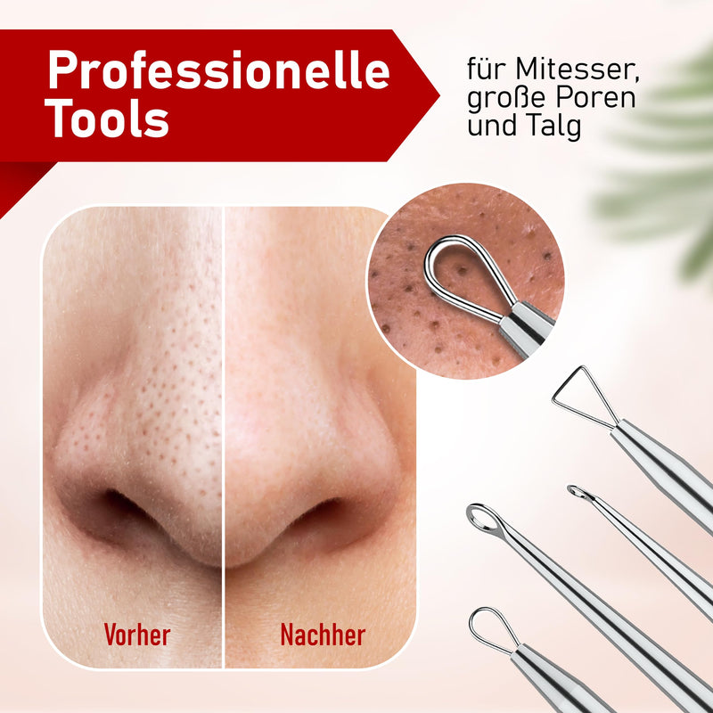 Neumann Blackhead Remover Set (Stainless Steel) For Removing Pimples, Blackheads Etc. - Comedone Squeezer, Lifter, Remover - Various Tools: Loops, Tweezers, Lancet [Silver] - NewNest Australia