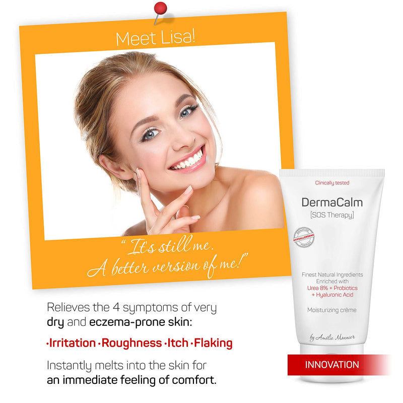 Clinically Tested Cream for Eczema, Dermatitis and Psoriasis Treatment - Urea 8%, Probiotics w/Best Natural Ingredients - Face & Body Lotion - Itchy, Severely Dry, Scaly Skin. Moisturizer - NewNest Australia