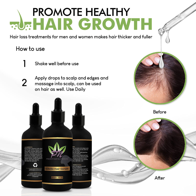 Priddyfair Nutrition Chebe Hair Growth Serum 100ml contains Biotin rich Fruits & Herbs for Anti Hair Loss Hair Serum Growth Treatment Oil, Thinning Hair | Help Hair Follicle Growth For Men & Women - NewNest Australia
