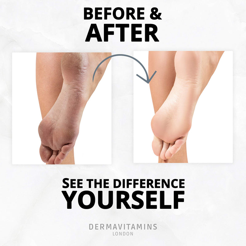 Dermavitamins Advanced Foot Mask Bag - Repairs Dry Feet (Peeling) Peeling - NewNest Australia