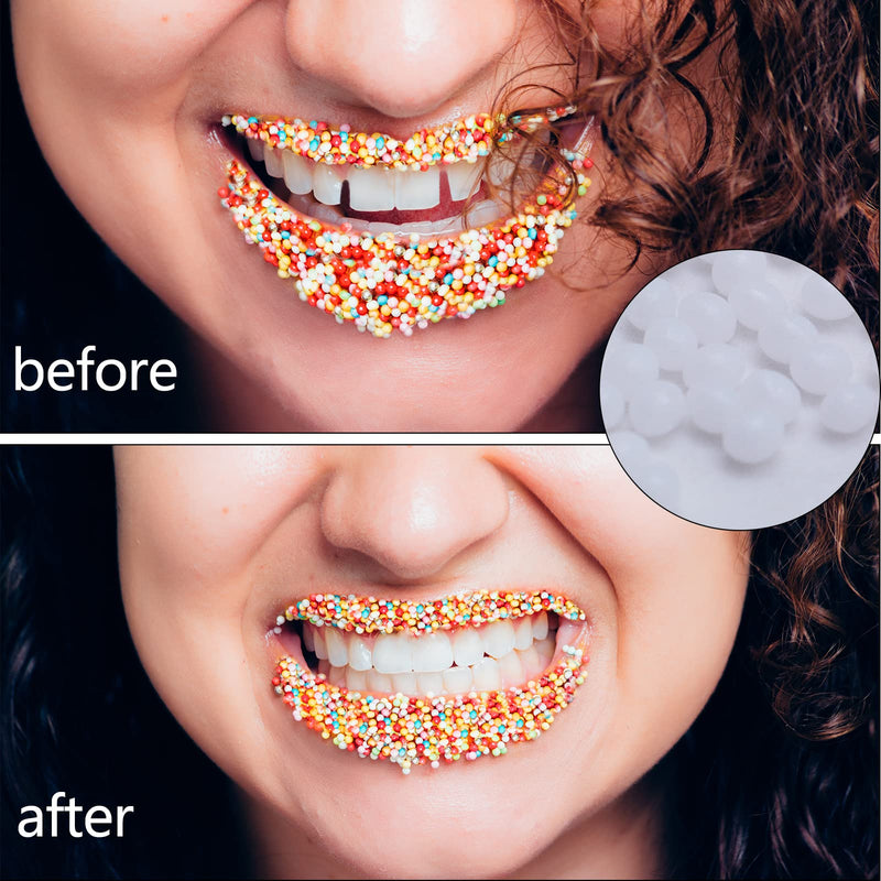 60g Temporary Tooth Repair Beads Tooth Filling Replacement Thermal Adhesive Fitting Beads Teeth Fixing Tooth Beads Dental Tooth Filler Material Tooth Repair Kit for Missing Broken Fake Chipped Teeth - NewNest Australia