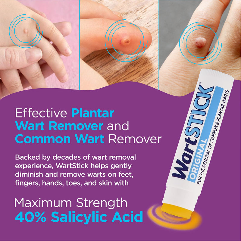 WartStick Maximum Strength Salicylic Acid Solid-Stick Common and Plantar Wart Remover 0.2 Oz - NewNest Australia