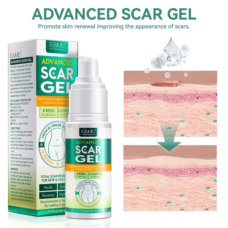 Silicone Scar Gel- Scar Removal Cream Gel, Stretch Mark Cream, Medical Advanced Scar Gel for Old and New Scar, Scar Cream for Surgical Scars, C-Section, Keloid, Acne Scars, Gentle Formula 50ML Green - NewNest Australia