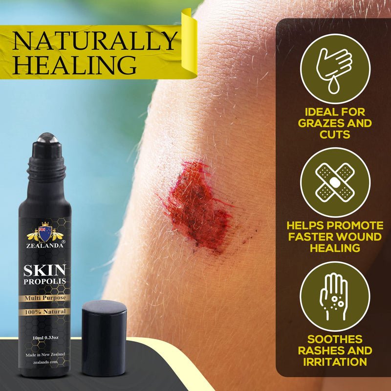 ZEALANDA Skin Propolis, Multi Purpose 100% Natural No Alcohol Treatment for Acne, Pimple, Eczema, Callus, Sunspot,Skin Rash, Insect Bites, Cuts & Wounds. Made & Packed in New Zealand - NewNest Australia