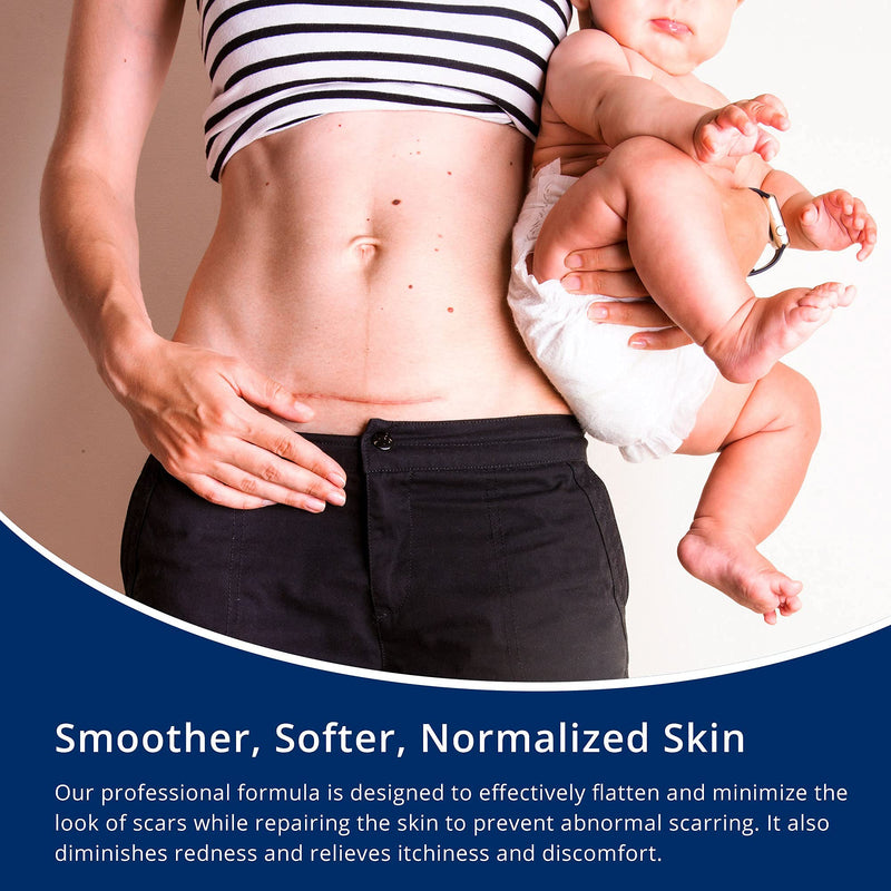 Scar Gel silicone scar gel from C-Section, Stretch Marks, Acne, Surgery, Effective for both Old and New Scars - NewNest Australia