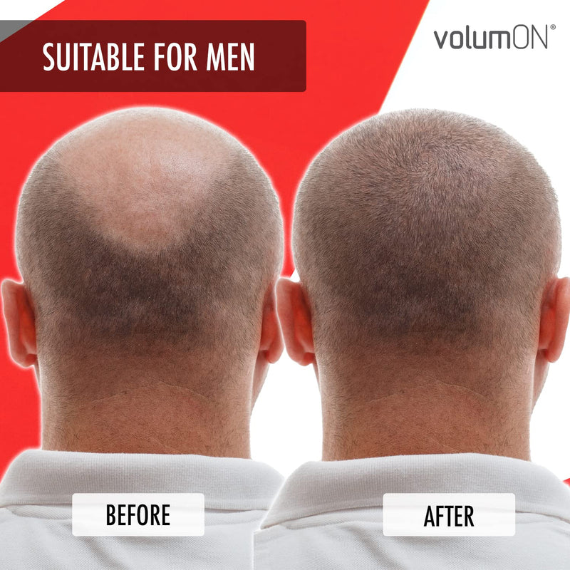 Hair Fibres x2 VOLUMON Keratin Hair Building Fibres for Thinning Hair - Instantly Conceals Thinning Areas for Fuller Thicker Hair - For Men & Women 28g x2 (Auburn) Auburn - NewNest Australia