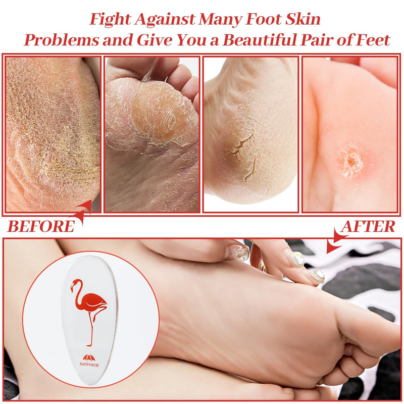 Sunivaca Glass Foot File Callus Remover for Feet, Flamingo Gifts for Women, Feet Scrubber Dead Skin Remover, Professional Pedicure Tools at Home, Heel Scraper for Cracked Heels Heavy Duty - NewNest Australia