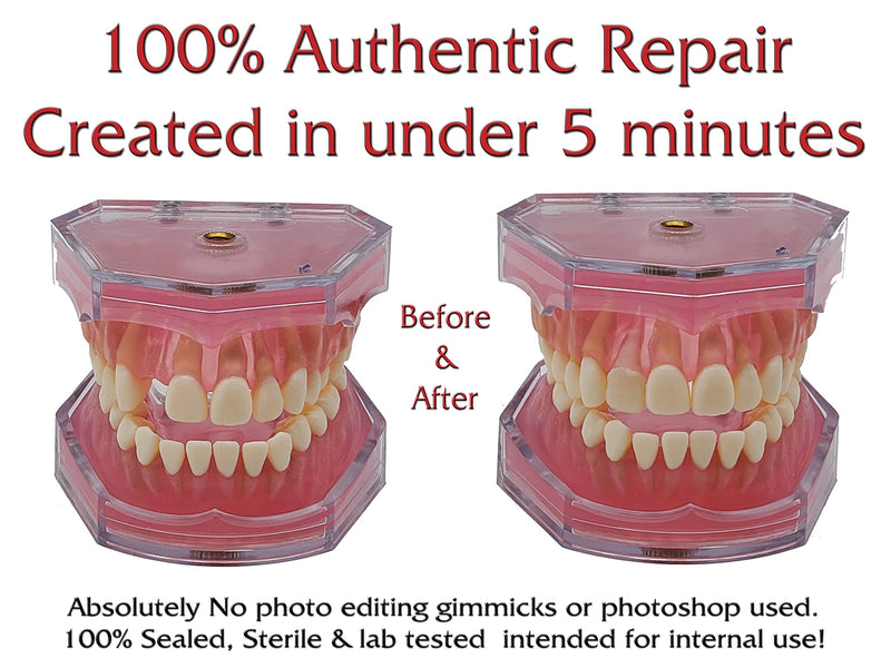 SmileFix Standard Color Matching Dental Repair Kit – Hide & Fix Smile with missing or broken tooth and teeth. Filled space quick & safe. Regain your confidence and beautiful smile in minutes at home! - NewNest Australia