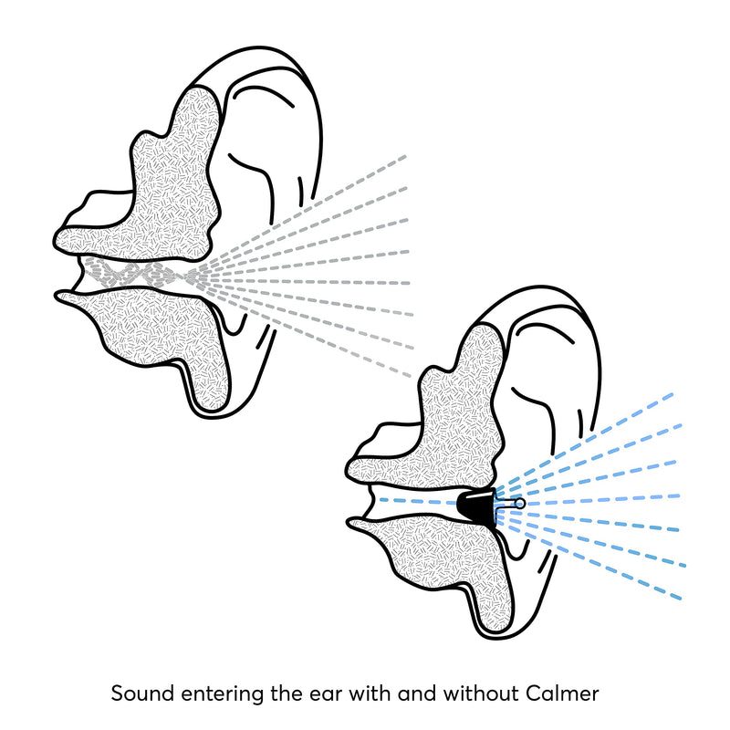 Flare Audio® Calmer® Night Black – in Ear Device to Gently Soothe Sound sensitivities - Reduce Stress in The Evening and Whilst Sleeping 1 Count (Pack of 1) - NewNest Australia