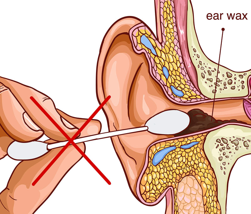 REMOS ear loop stainless steel for removing earwax, 7 cm long, satin - NewNest Australia