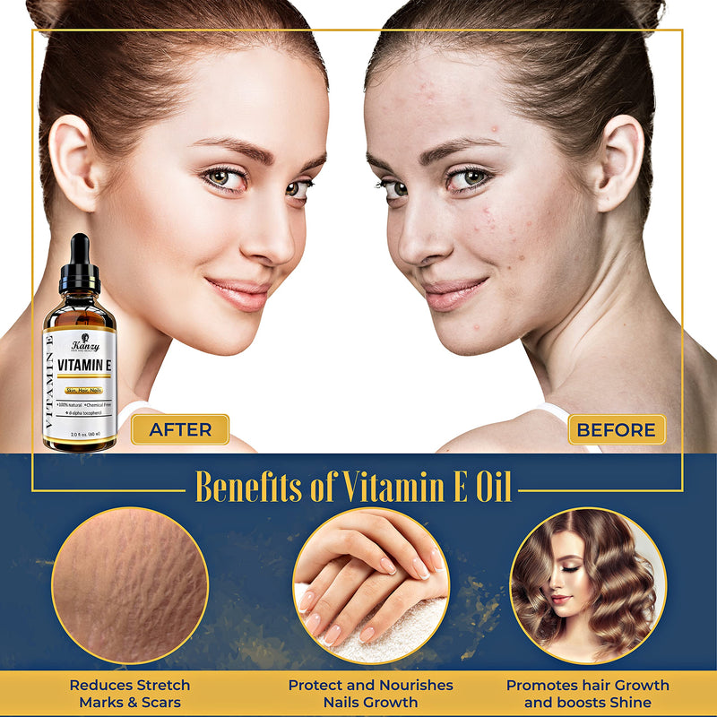 Kanzy Vitamin E Oil for Face & Skin 100% Naturally Sourced Plant-Based Organic Pure Vitamin E Oil for Hair d-Alpha-tocopherol Body Oil for Women & Men, Strengthens & Moisturizes Nails 60ml Body Oil - NewNest Australia