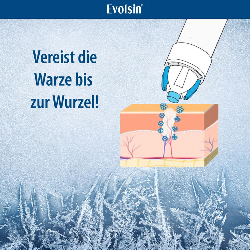 Evolsin® wart icing spray for common warts and plantar warts I wart icing hygienic & safe I clinically confirmed effect I wart remedy + 12 applicators - NewNest Australia