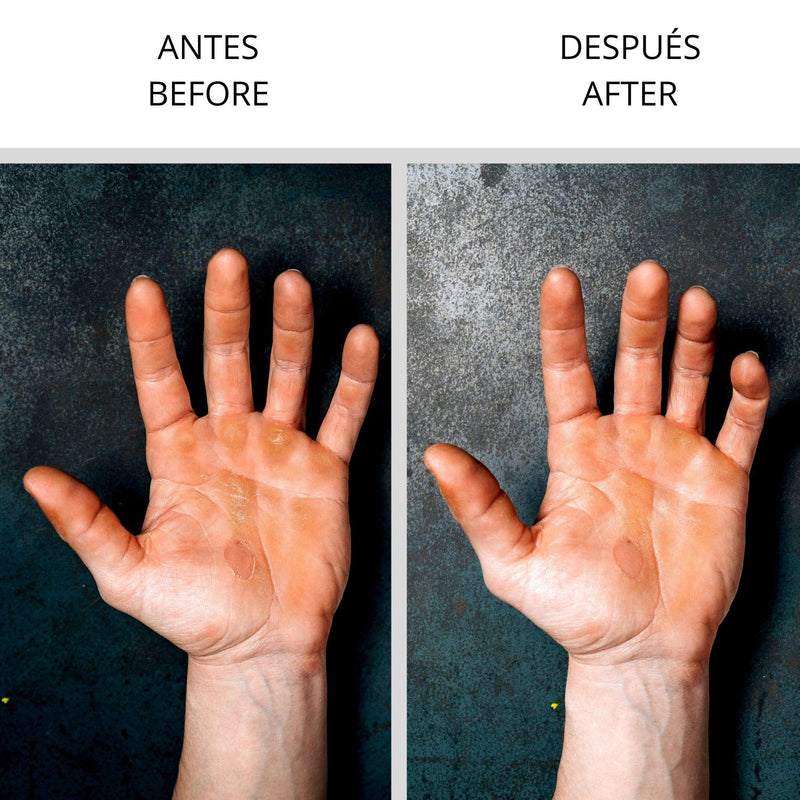 Velites Strong Sandpaper Replacement Part For Callus Remover And Skin Care System For Athletes, Hand And Feet Callus Remover For Crossfit, Gymnastics, Climbing And Running, Stone Skin Care System - NewNest Australia