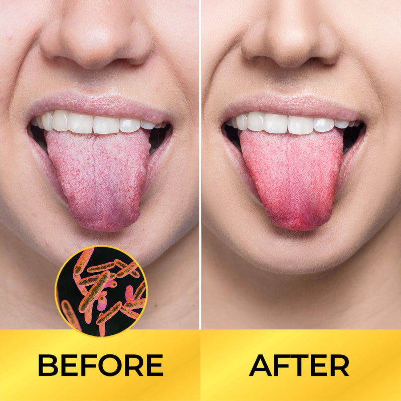 Tongue Scraper (Variety 2 Pack), Reduce Bad Breath, Stainless Steel Tongue Cleaners, Metal Tongue Scrapers Fresher Breath in Seconds 2 Piece Set - NewNest Australia