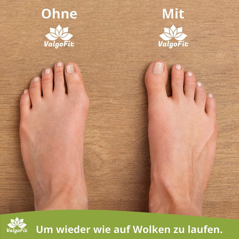 ValgoFit® silicone toe spreader - [8x] - transparent - hallux valgus correction - optimal spread and natural alignment of the toes - bunion correction including training band and eBook - NewNest Australia