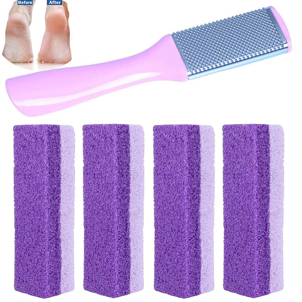 TeTupGa Pumice Stone Exfoliating Callus Dead Hard Skin Remover File Scrubber Pedicure Foot Care Tool Pack of 5 - NewNest Australia